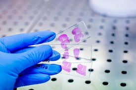 Histopathology
